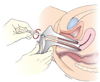 体检妇科不过怎么办,体检中哪些妇科病不用治