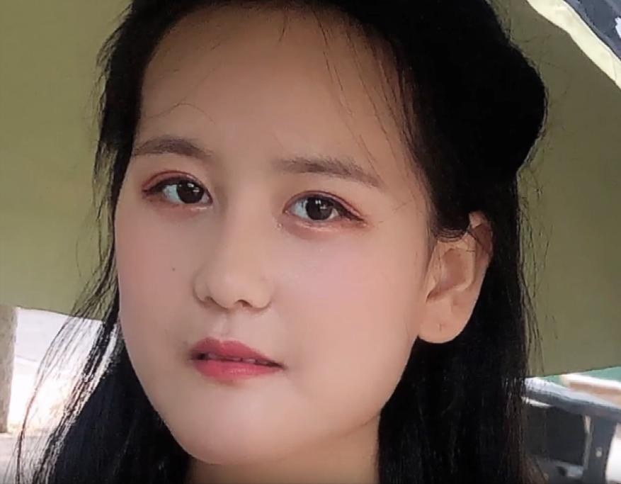 东北“歪脸”女孩整形成大美女，拒绝当网红，只想回山村当教师