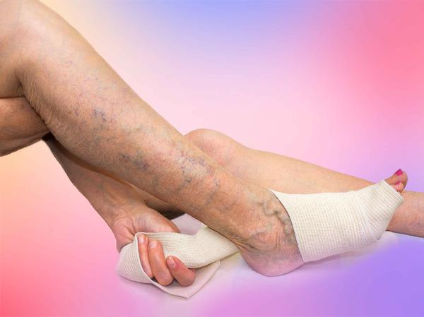 脚踝扭伤两个月跑步脚踝里面还疼,跑步脚踝内侧胫骨疼痛是什么原因