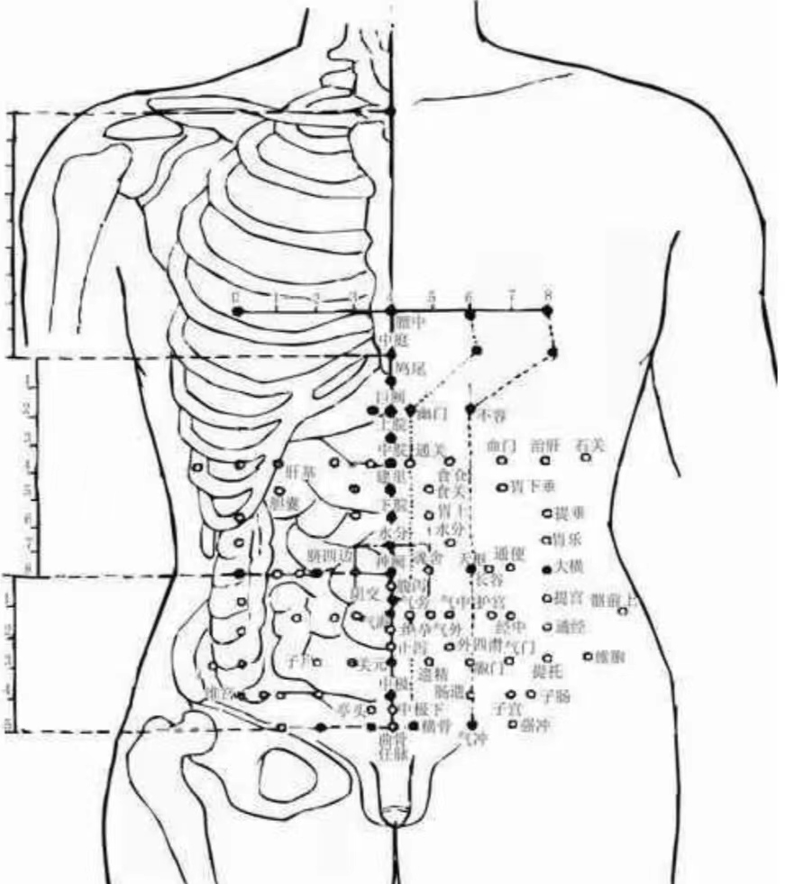 腹针疗法,腹针疗法最新处方大全