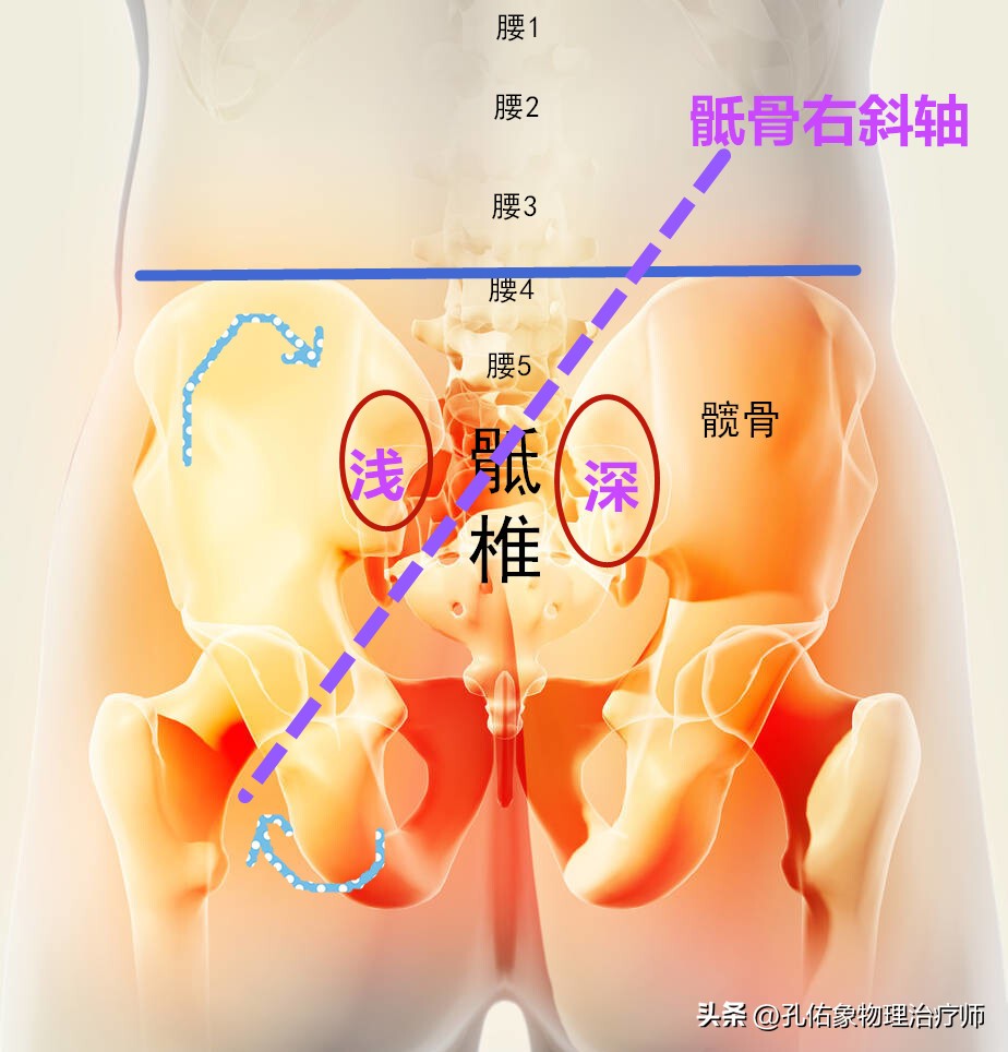 早上起床腰痛运动后缓解是什么病,腰痛怎么睡可以缓解疼痛