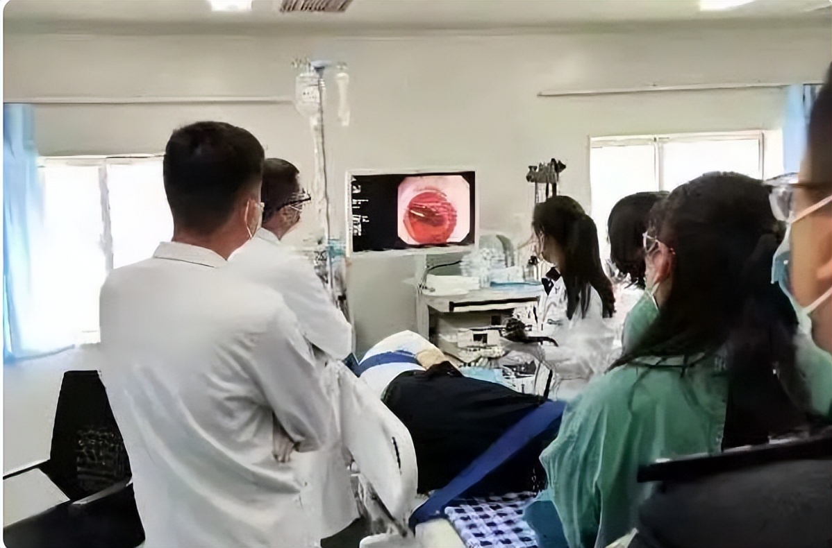 患者吞下15cm“中性笔”星元医院医生耗时3小时成功将其取出