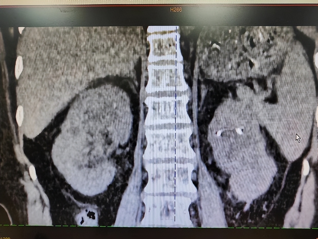 “医”心不凡|黄耀：患者的信任与笑容，都是值得的努力