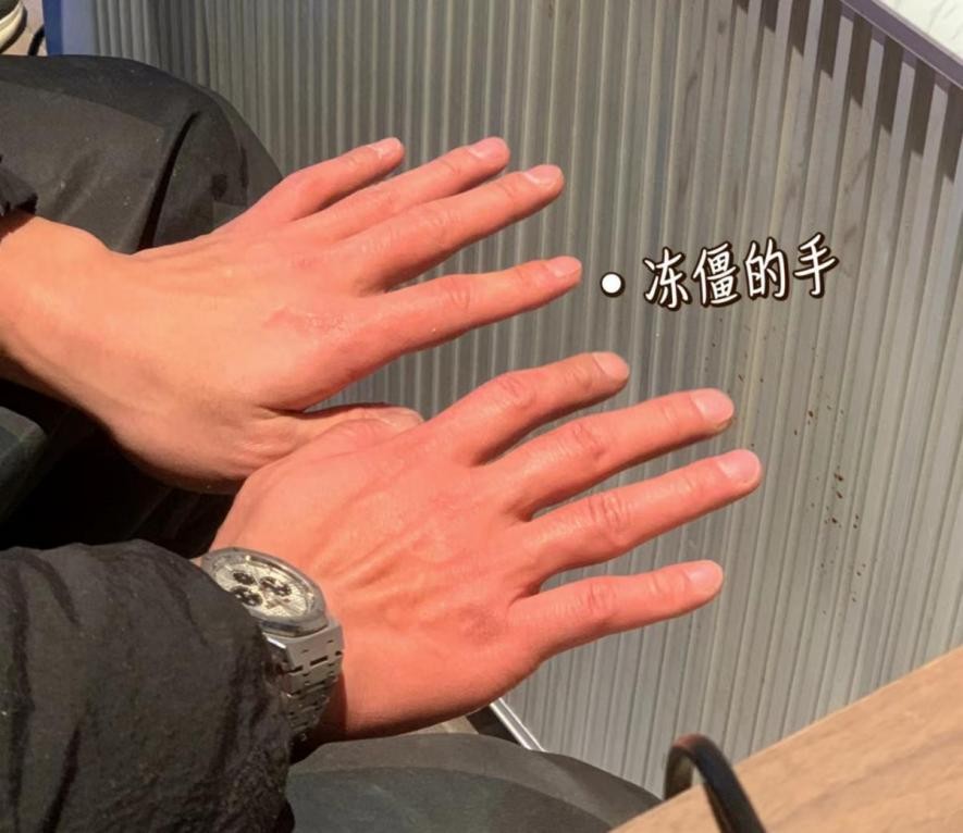 我500强干了7年，钱赚不少却累虚脱，今裸辞投300万在*疆新**开民宿