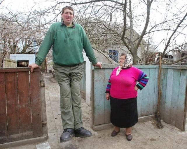 男子身患巨人症身高竟有两米四二,外国夫妇生了巨人症的孩子