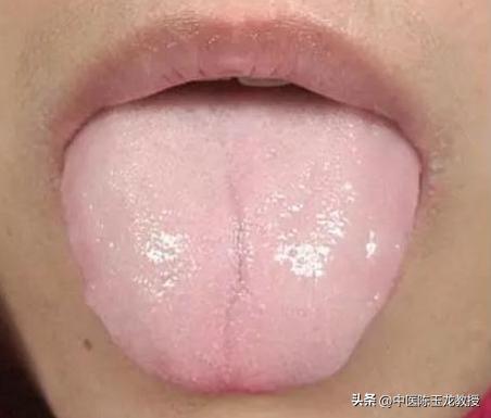 中医才知道的补阳老方暖身驱寒,道家补阳第一秘方虚寒体质的福音