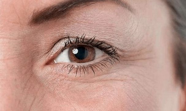 皮肤出现细纹后开始抗老来得及么,用护肤品皮肤反而细纹更多