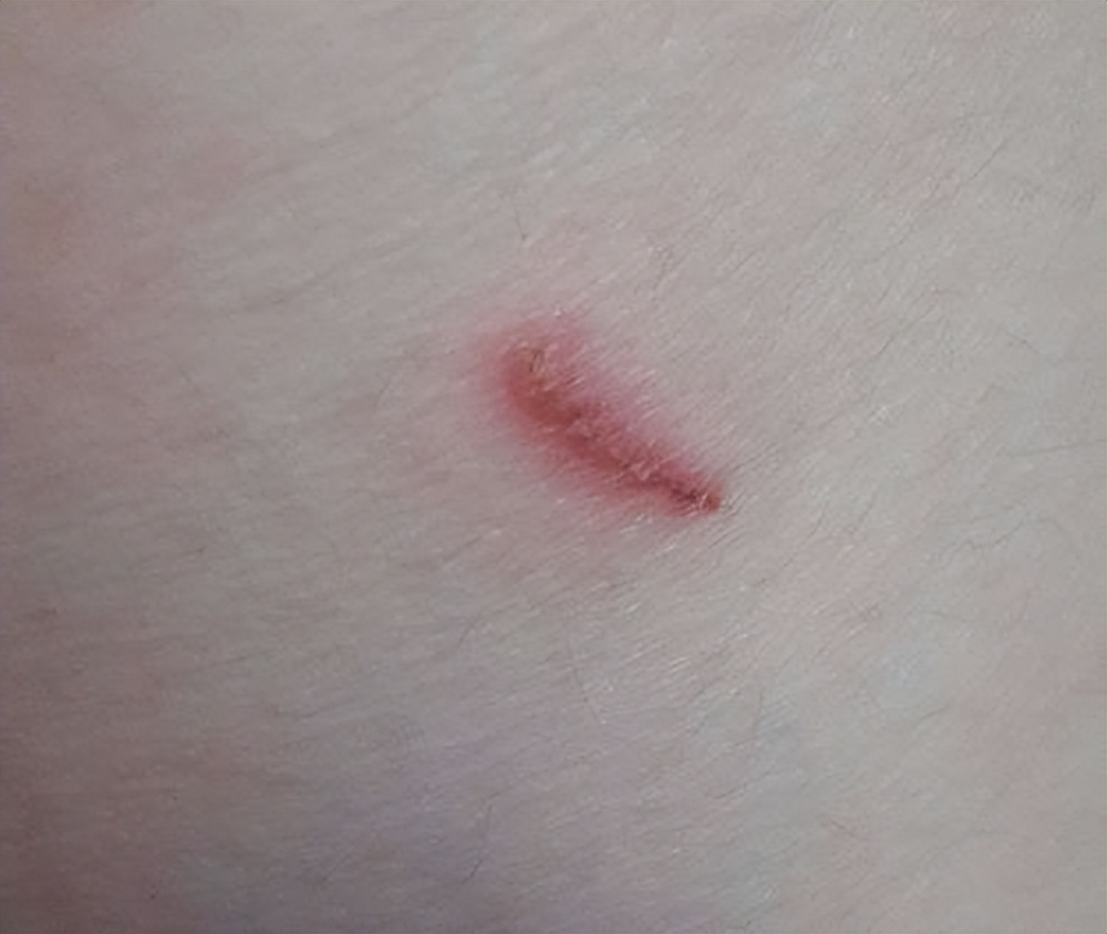 医生增强抵抗力的保健品,医生推荐增强免疫力吃啥最好