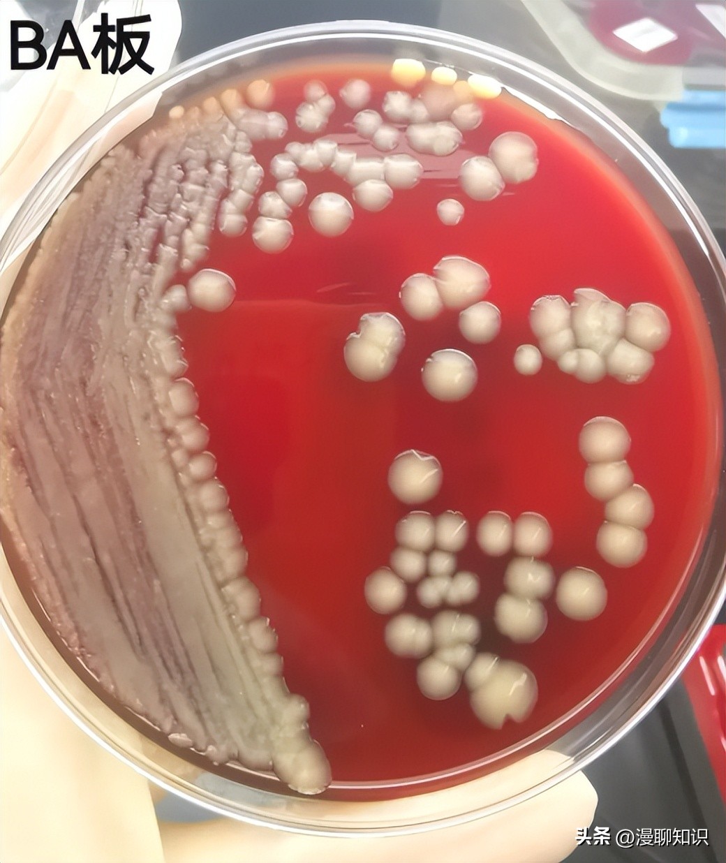 老年人得了肺炎应如何有效医治,肺炎有多严重怎么办