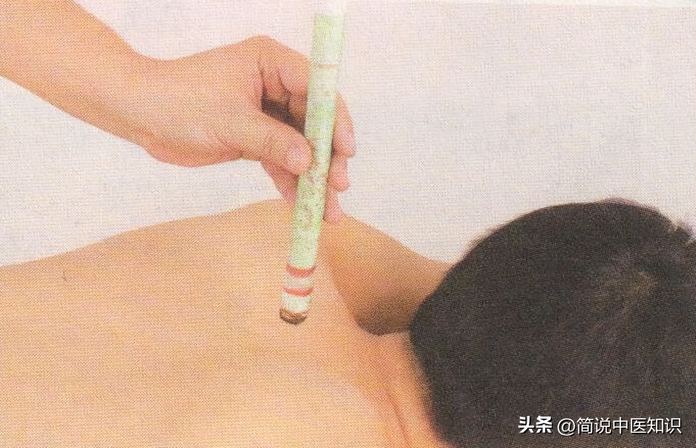 简明中医知识：风寒感冒如何使用穴位居家治疗