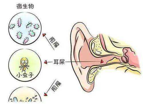 肚脐眼的黑泥到底可不可以抠,人体的秘密全部视频