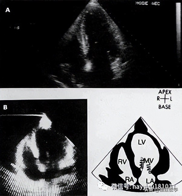 休克评估与处理课件,休克评估最有效指标