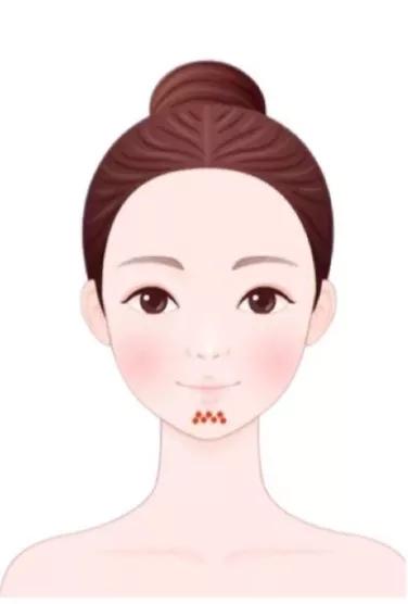 脸上有痘生活小妙招,你有什么方法改善脸上的痘痘