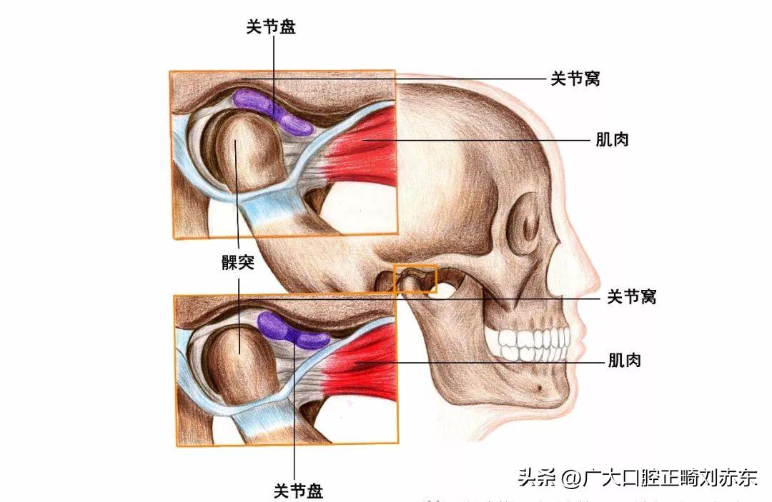 导致大小脸最关键的原因,造成大小脸的原因和矫正方法