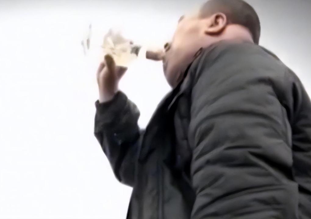 男子喝酒脖子成河马,喝酒喝成河马脖子病