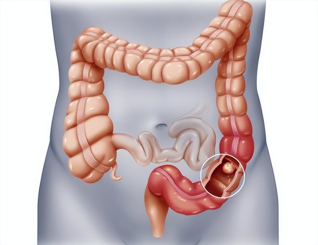 食品中铝残留和含铝添加剂有关吗,铝食品添加剂的危害