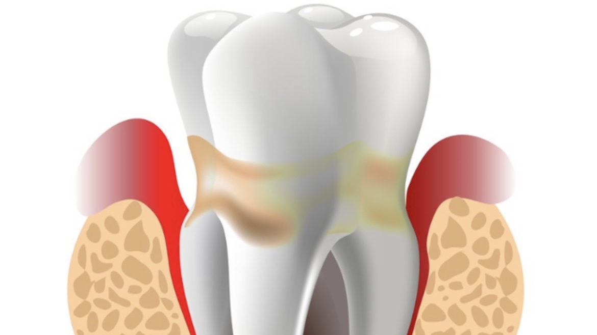 一瓶100毫升甲硝唑多少钱,几块钱的甲硝唑能有三种作用