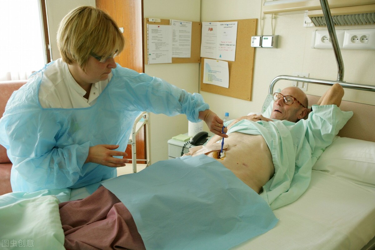 造口病人的护理,造口护理指南