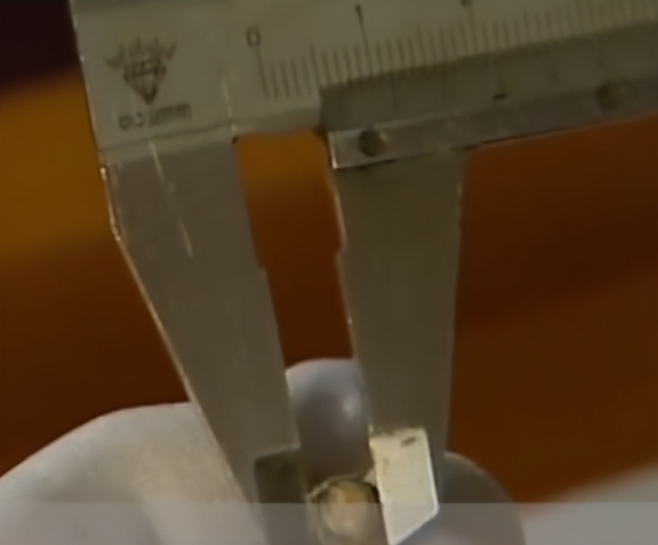 故事:江苏70岁老人头疼欲裂,检查时发现颅内有*弹子**,吓坏在场医生