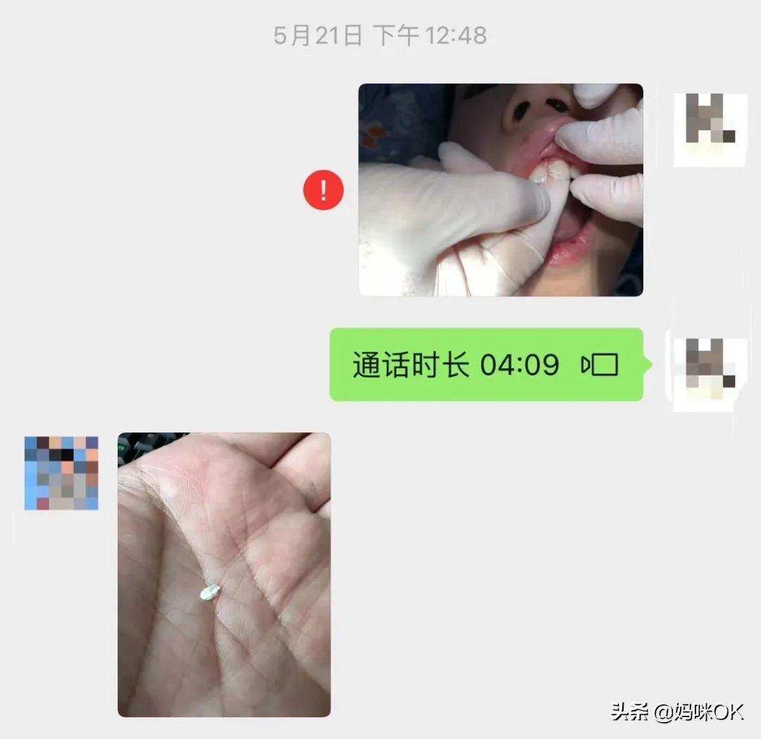 18岁前不能再用门牙吃东西！儿子的这一跤摔得有点惨痛