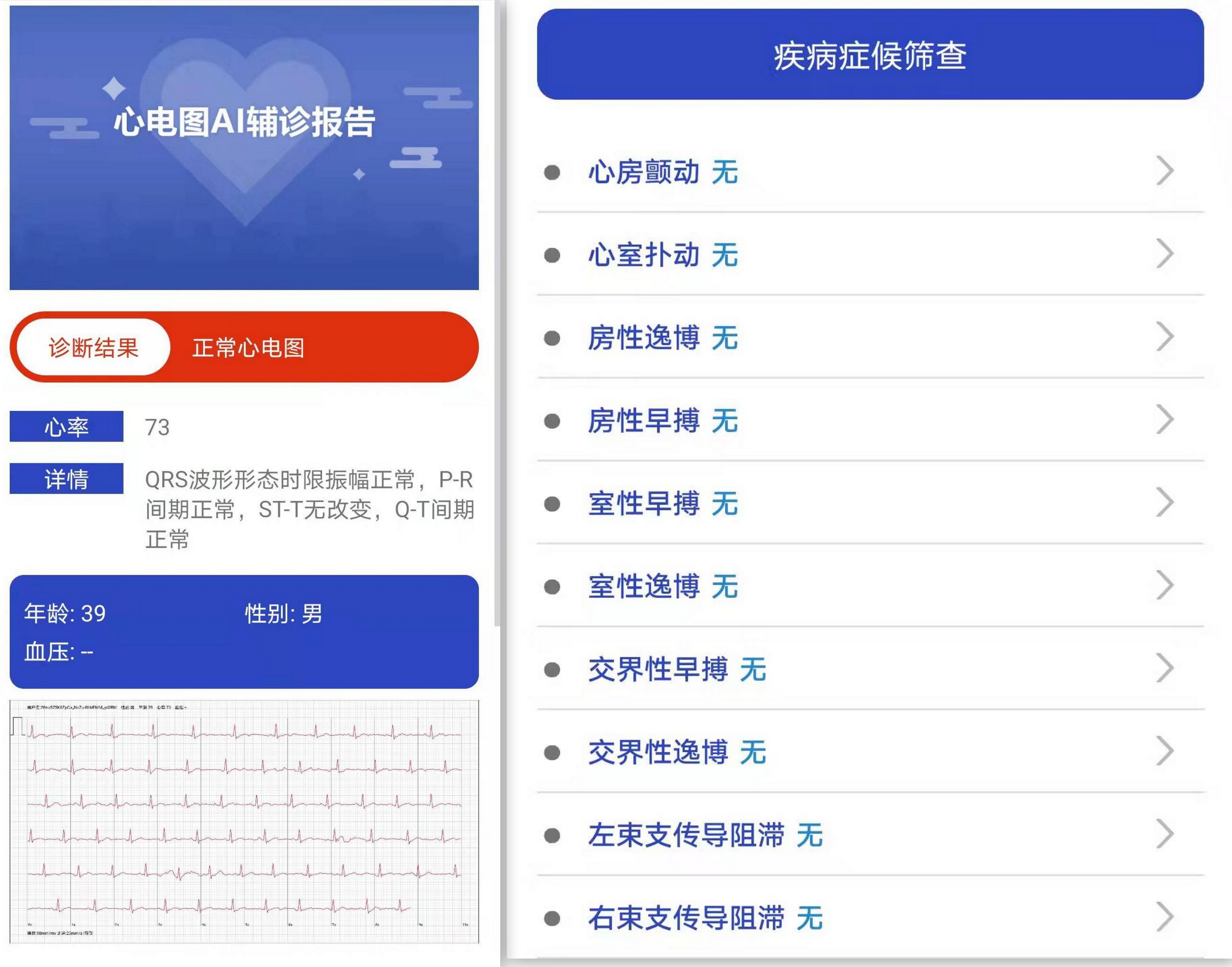 didoe10s智能手表,didoe10手表评测