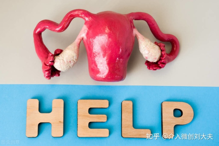 超声介入穿刺治疗巧克力囊肿,介入卵巢巧克力囊肿