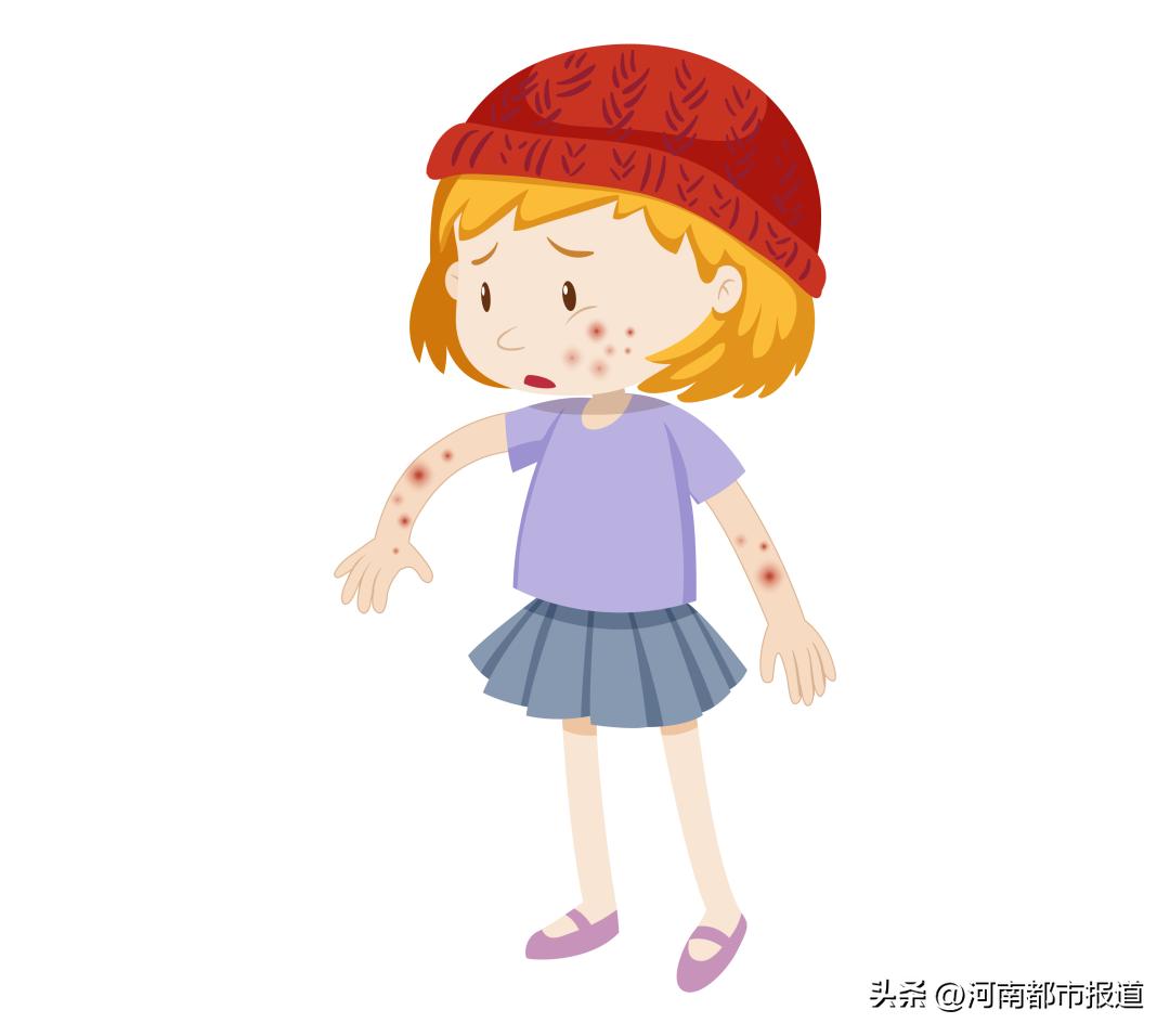 身上突发大面积红疹发痒,身上红疹遇热后发痒