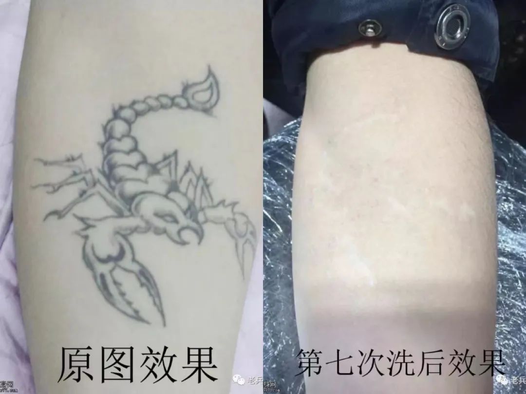 怎样洗纹身对皮肤的损伤小,不伤皮肤的洗纹身方法