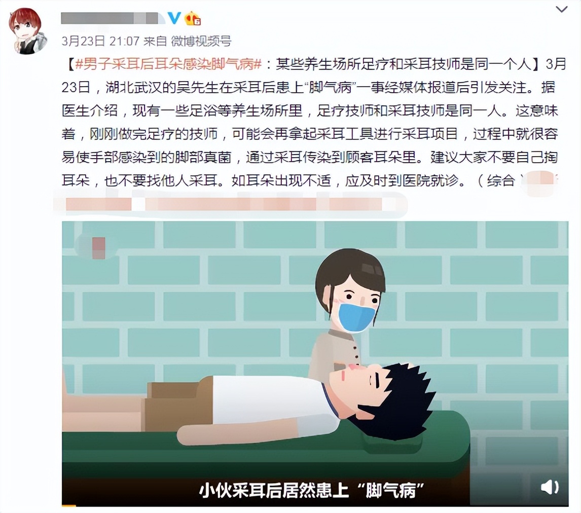 肚脐眼的黑泥到底可不可以抠,人体的秘密全部视频