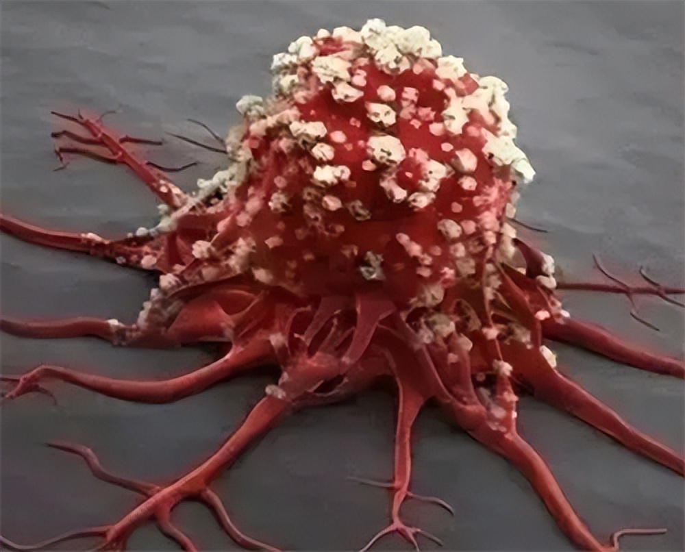 哪种血型容易患癌症,血型ab型会生癌症吗