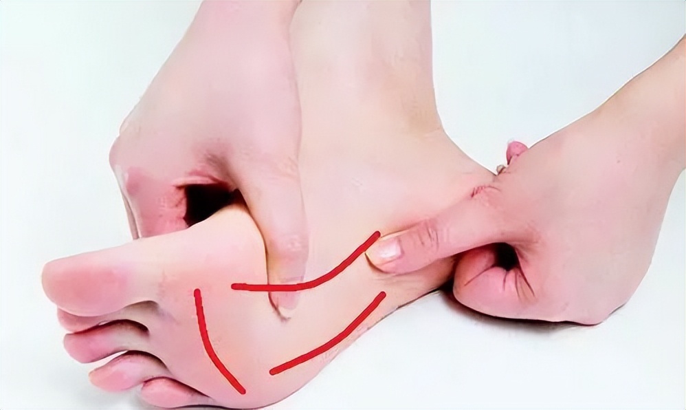 足部护理足跟痛,脚后跟粉碎足外翻怎么治疗