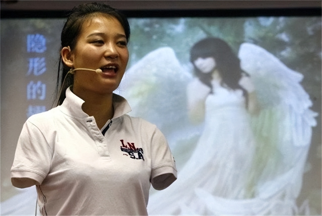 截肢女孩雷庆瑶近况,雷庆瑶触电事件