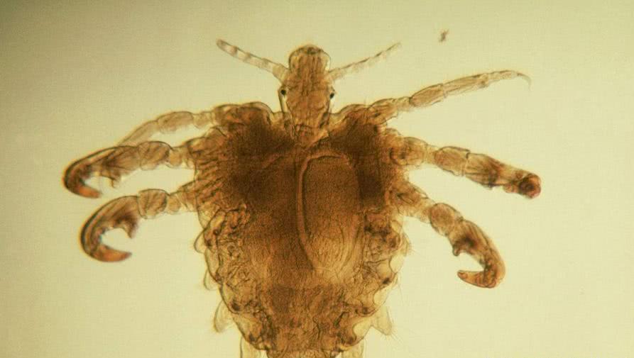 阴虱是什么？为啥有人好端端就染上了？医生：离不开5个传播途径