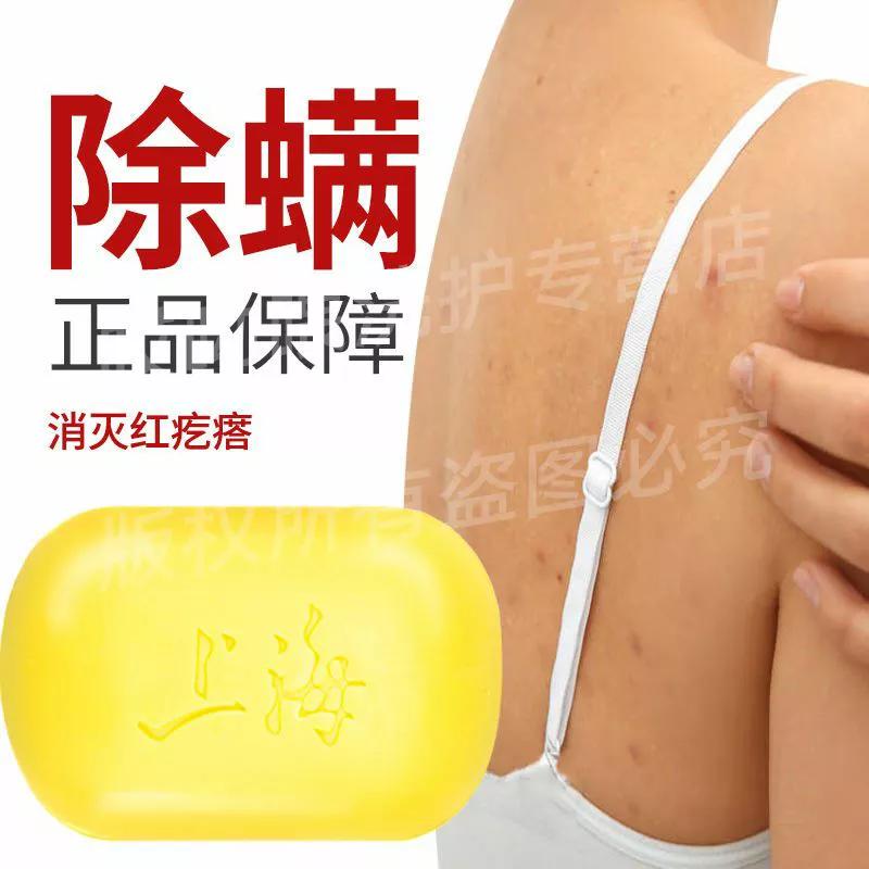 拼夕夕好物推荐之祛痘神器 (拼夕夕好物推荐面部清洁)