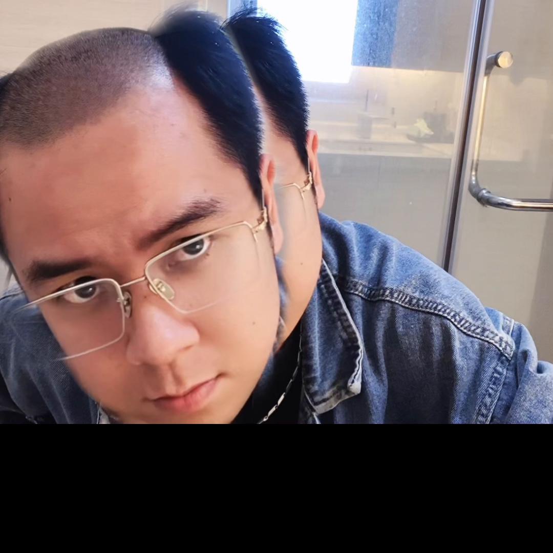 做个帅气的假发该花多少钱#沙僧补发#无痕补发#深圳补发