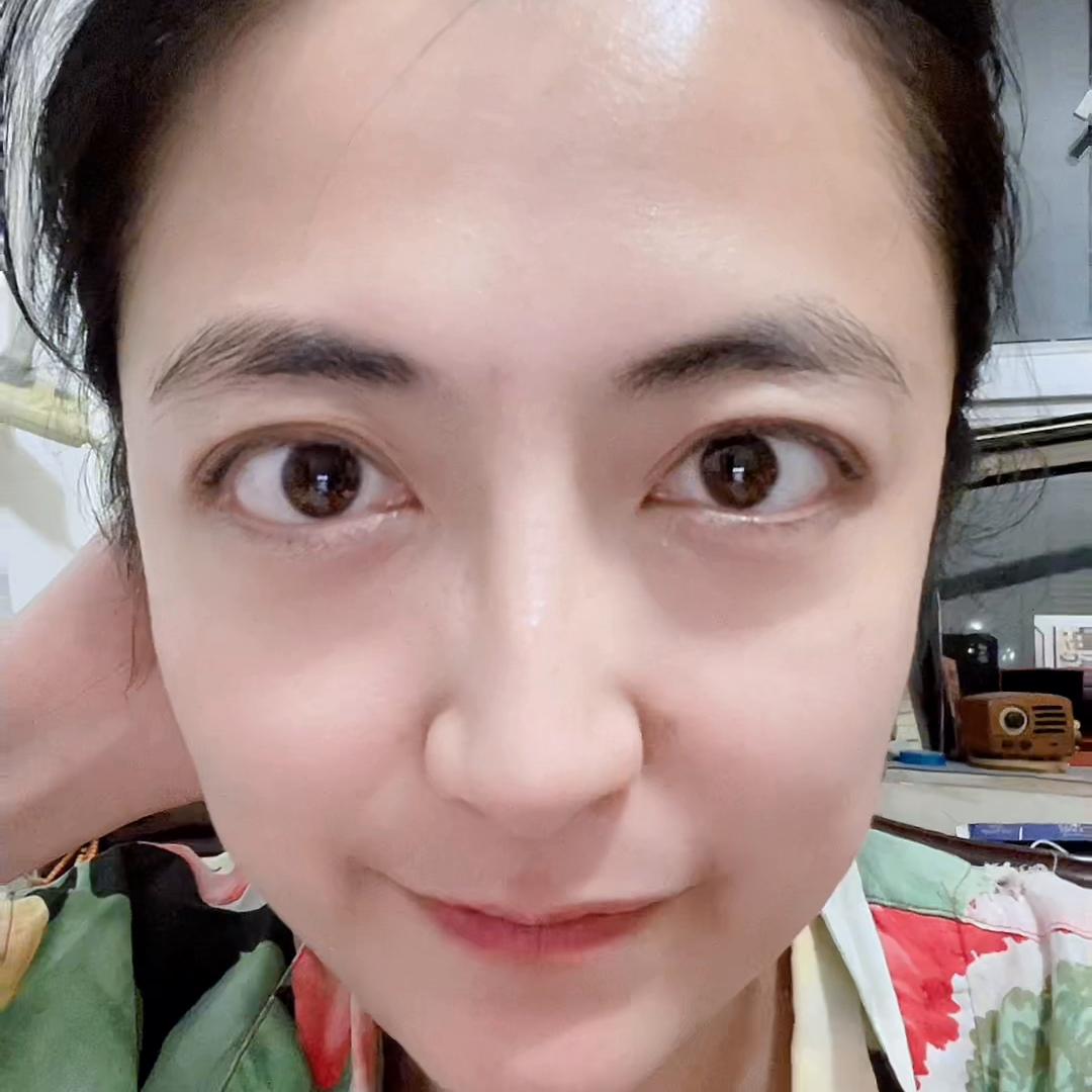 4个月之后，脑雾好了，新世界的门儿也开了~祝大家早日恢...