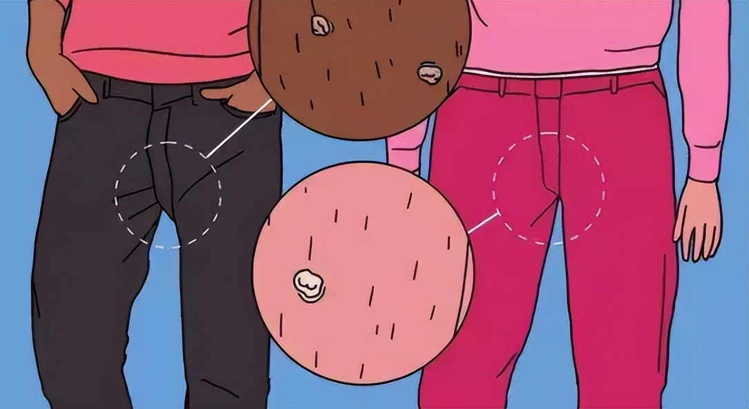 女生得了一颗尖锐性湿疣,女性肛周长湿疣什么原因