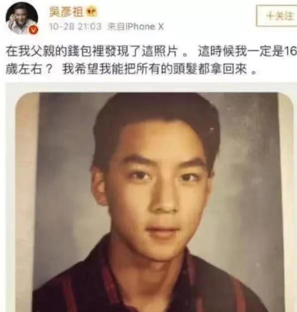 有哪些明星头发秃顶,秃顶明星发际线