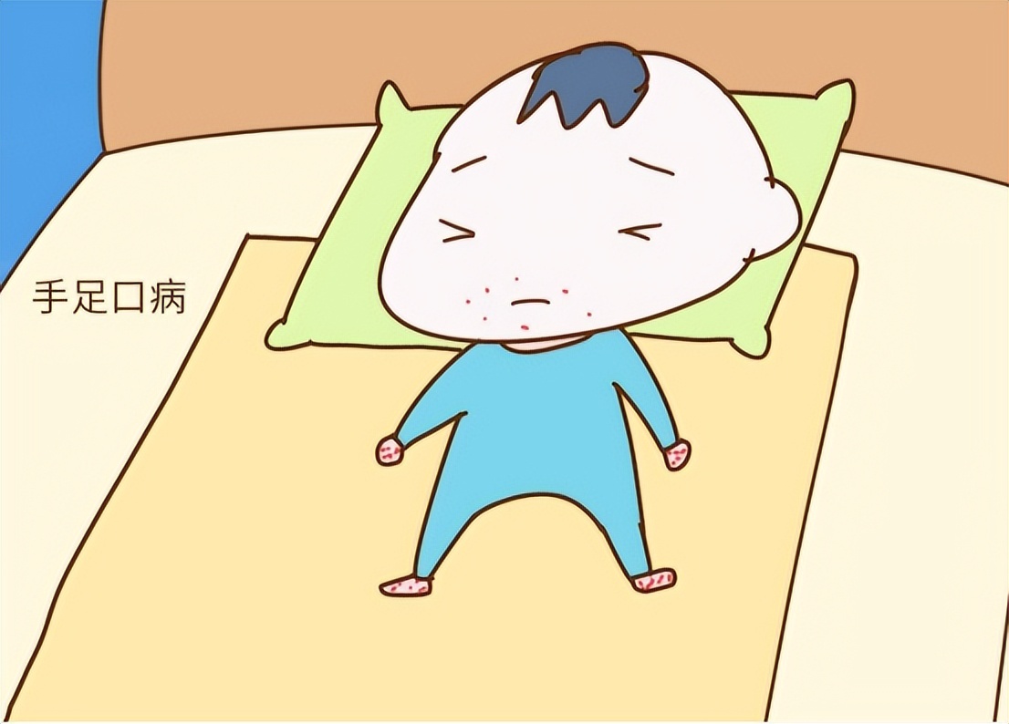 儿童夏季嗓子疱疹,儿童口腔起疱疹喷什么药可以缓解