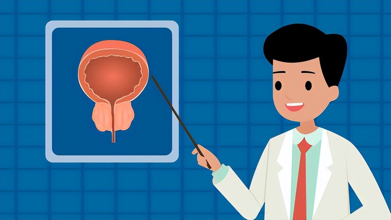 如何判断前列腺癌是早期还是晚期,前列腺癌发现就是晚期