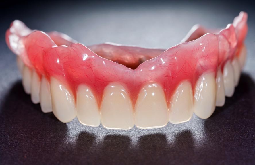 牙齿修复健康宣教知识,牙齿修复的十大常见问题