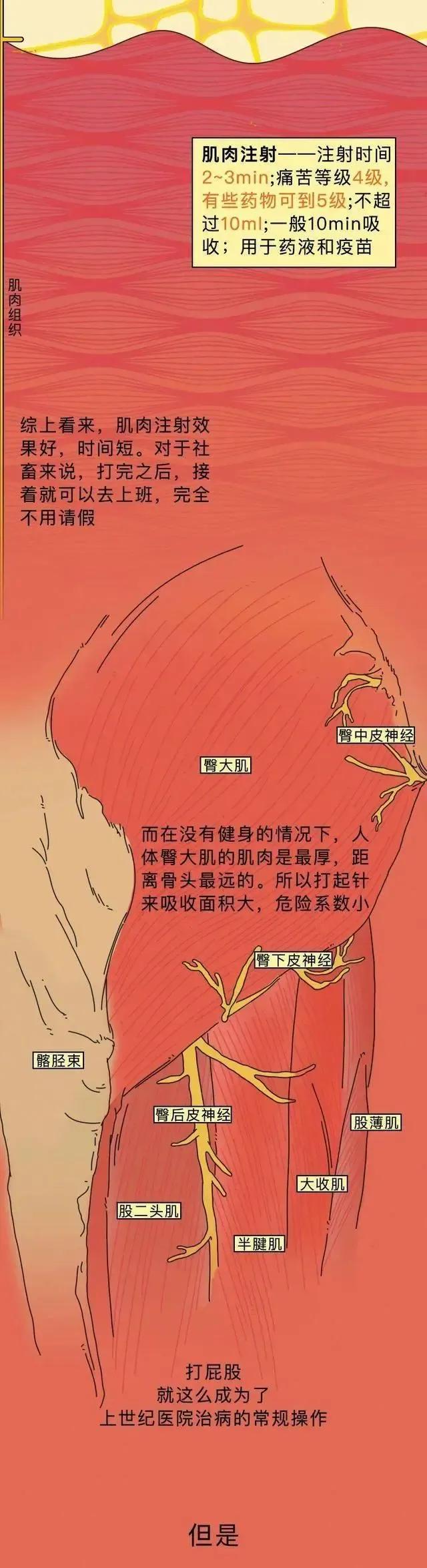 童年噩梦——“屁股针”，为啥那么痛？「漫画揭秘