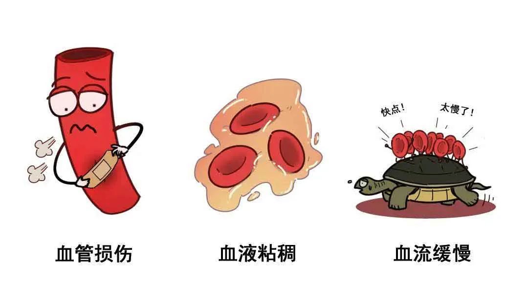 医者仁心|小滤器大作用！撑起生命的保护伞