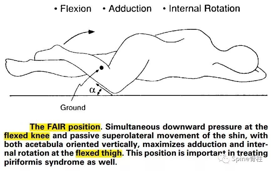 腰椎间盘突出下肢放射痛严重吗,下肢放射疼痛是间断性严重吗