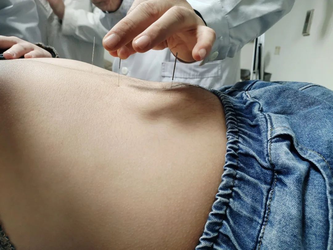 如何防治偏头痛,如何治偏头痛