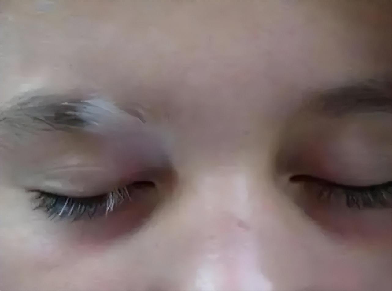 白癜风发现时从什么部位开始发现,各个部位白癜风哪里最好治疗