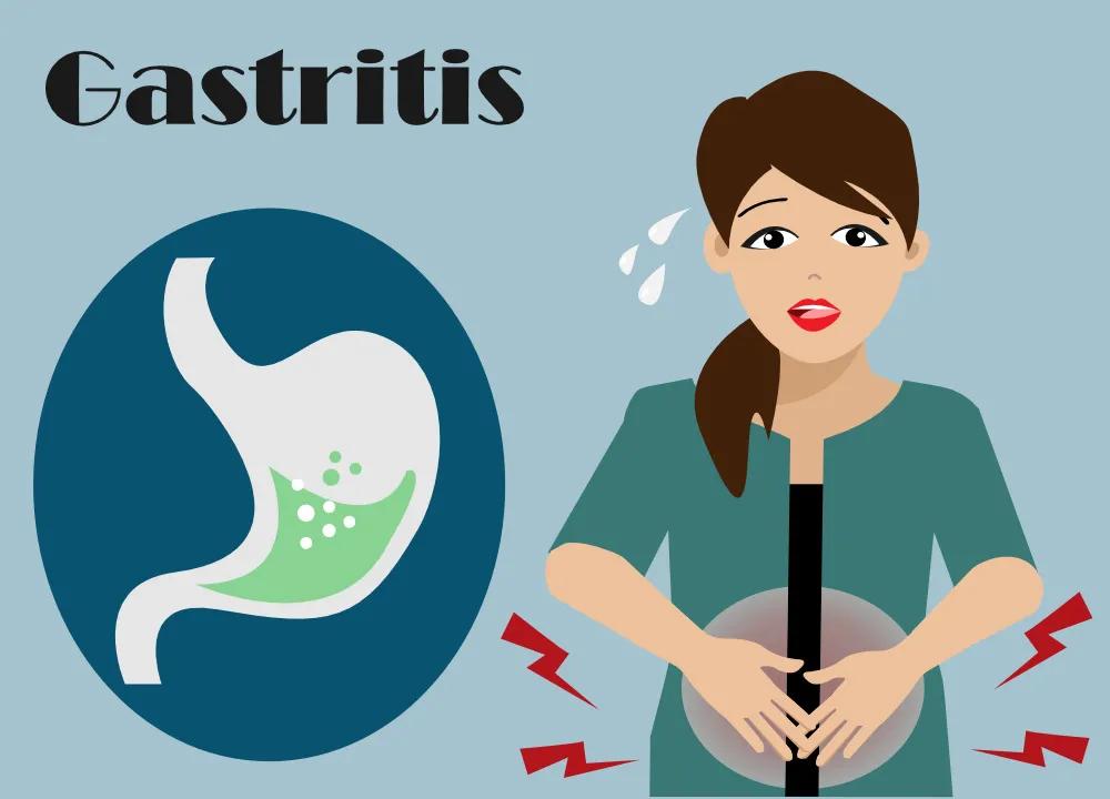 JAMA丨这项因素可能会取代幽门螺旋杆菌，成为导致胃癌的主要原因