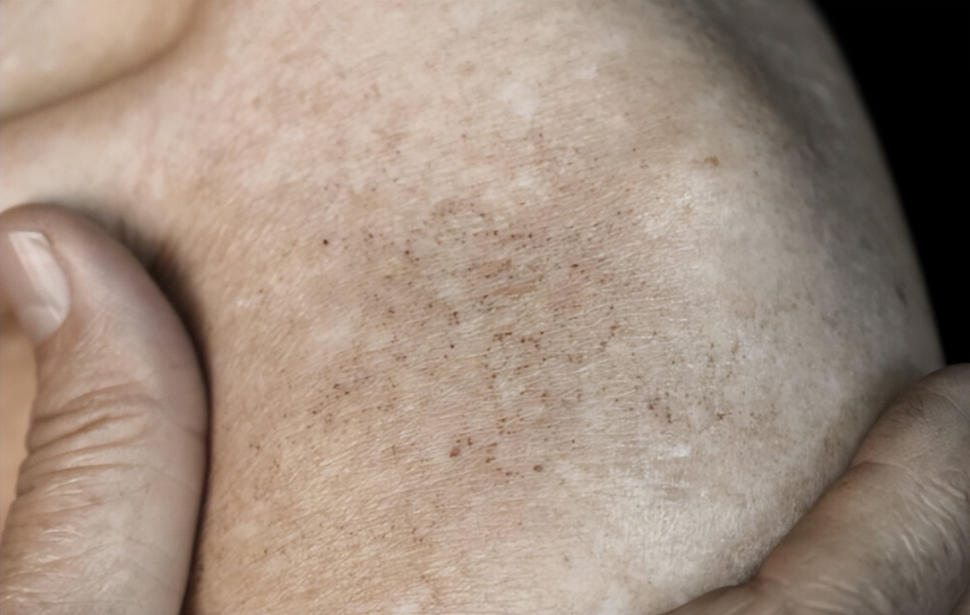 女性*处私**黑，是因为“经历”太多了？原因可能有这3个，别想歪了