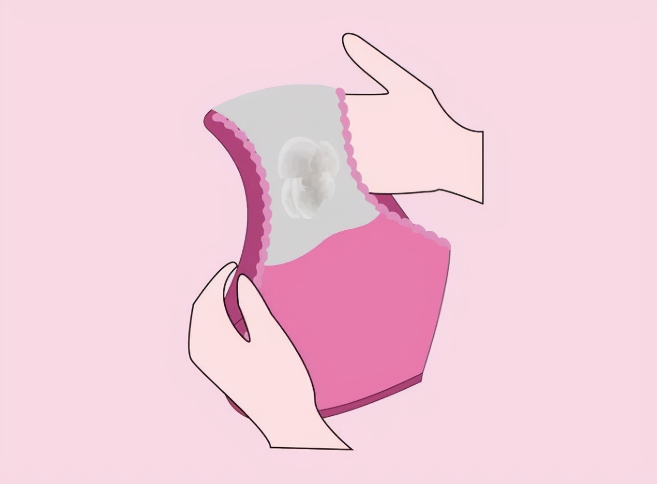 女性*裤内**上黄黄的分泌物是什么？不妨了解一下