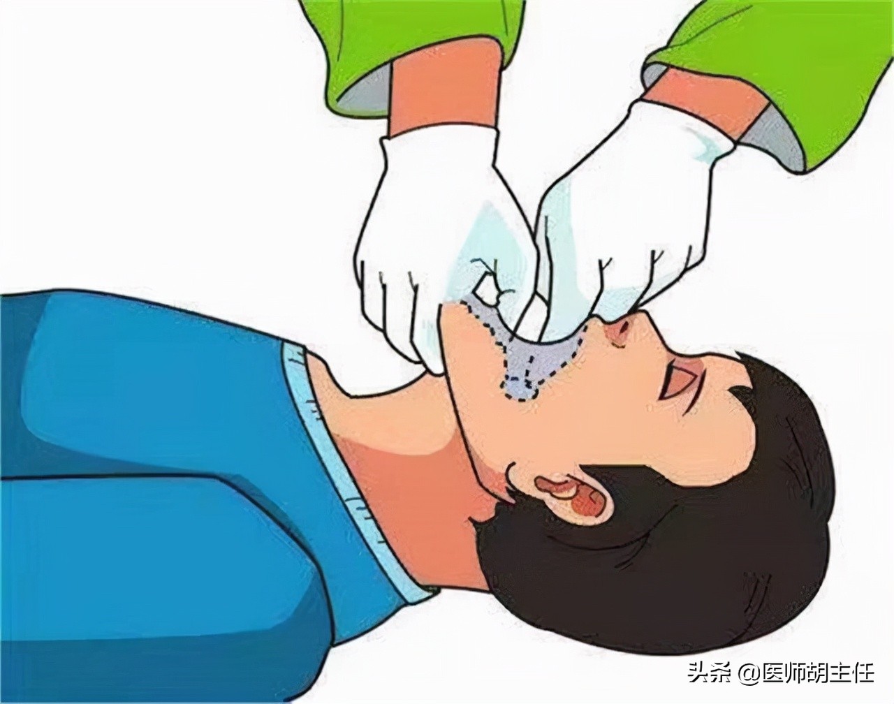 脑血管畸形导致的脑出血怎么急救,家里老人脑出血应该怎样安慰